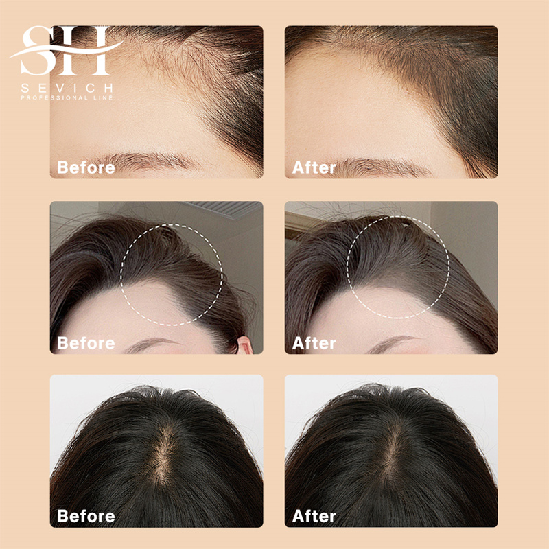 SEVICH 12g Hairline Powder Wit - Rooting Hormone Powder avis et prix
