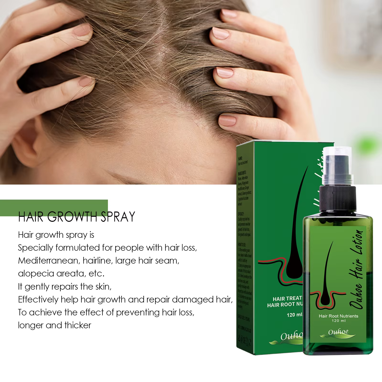 Hair Growth Spray Anti Hair Lo - Root Stimulator Liquid avis et prix